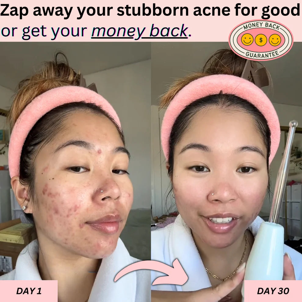 BeautyPro™ - High Frequency Wand